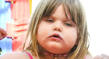 My girl was obese at 3