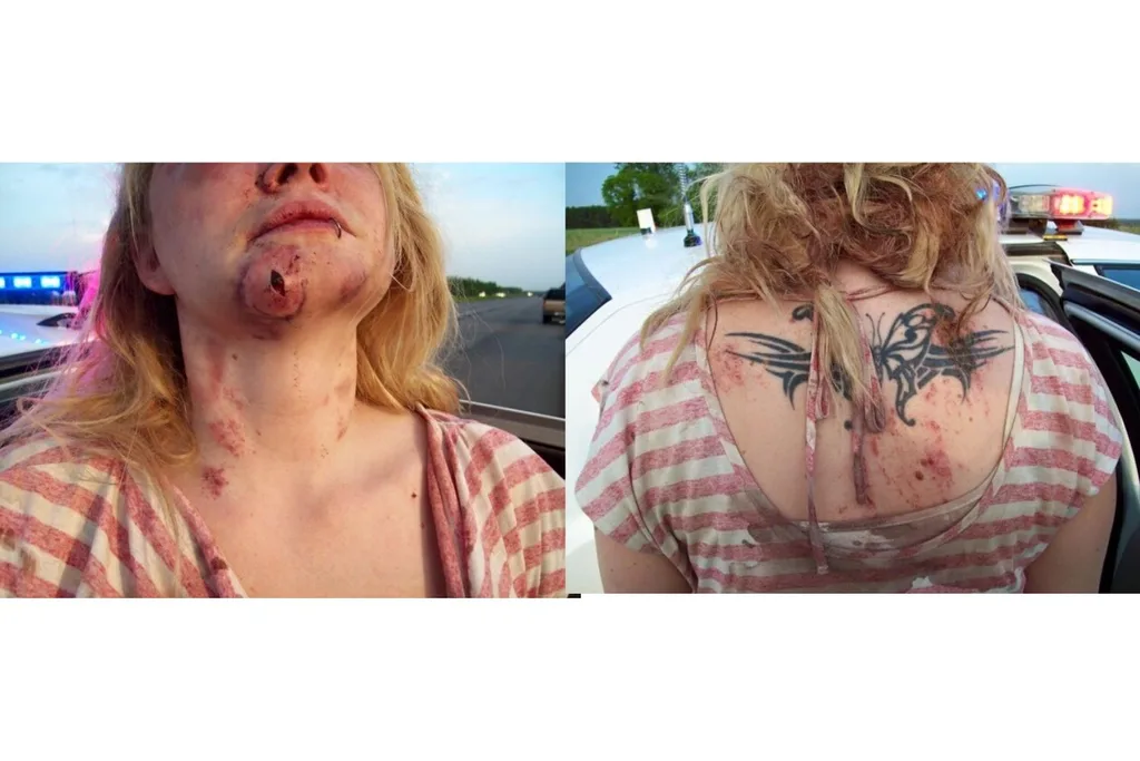 Jenna Schiller's injuries