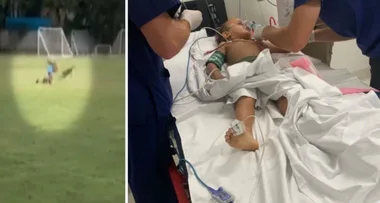 WARNING, DISTRESSING IMAGES: Wallabies attack boy, 4, in Cairns, leaving him bloodied and traumatised