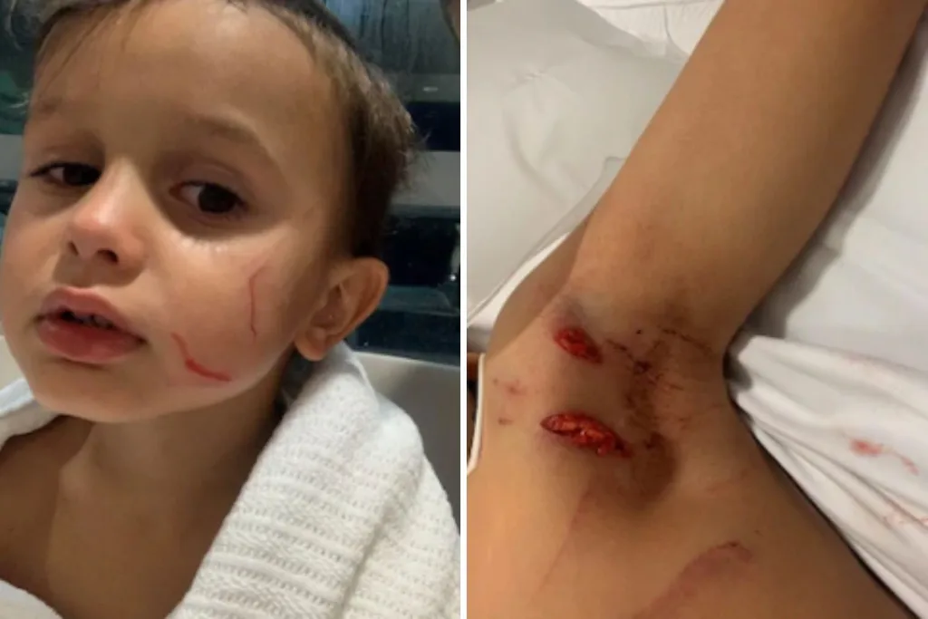 Queensland boy Elijah Deacon has been hospitalised with deep cuts in a wallaby attack.