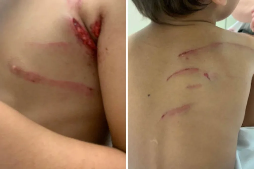 The Cairns boy was attacked while playing on a sports field.