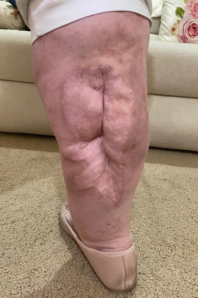 My leg now.