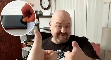 Man uses severed thumb to unlock phone!