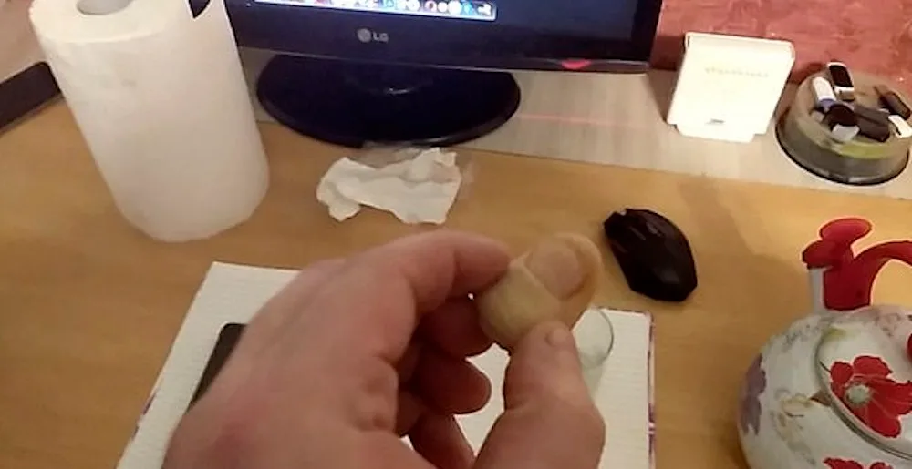 Man uses severed thumb to unlock phone