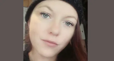 Medical shock! Woman who hit her head can’t smell anything!