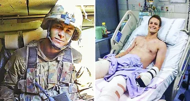 Anzac hero: ‘I lost my leg but it won’t stop me’