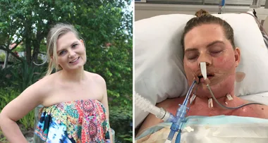 ‘I’m being strangled alive’ Aussie woman’s TOOTH put her in a coma