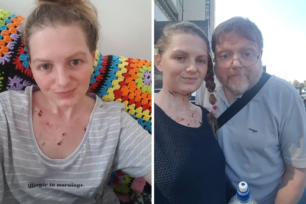 Caitlin was in a coma for nine days. Credit: Supplied