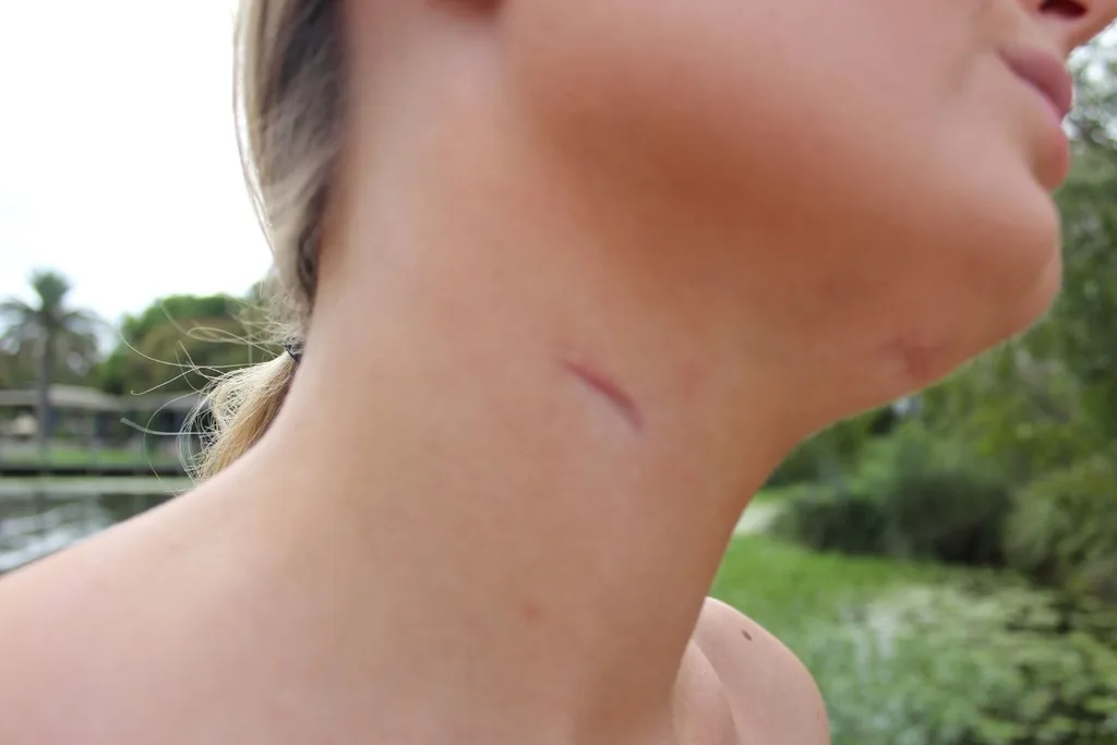 Caitlin is proud of her scars and what she's overcome. Credit: Supplied