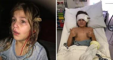 Mum’s horror: My girl had a stick in her head