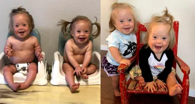 Mum of identical twins with Down syndrome was offered an abortion six times