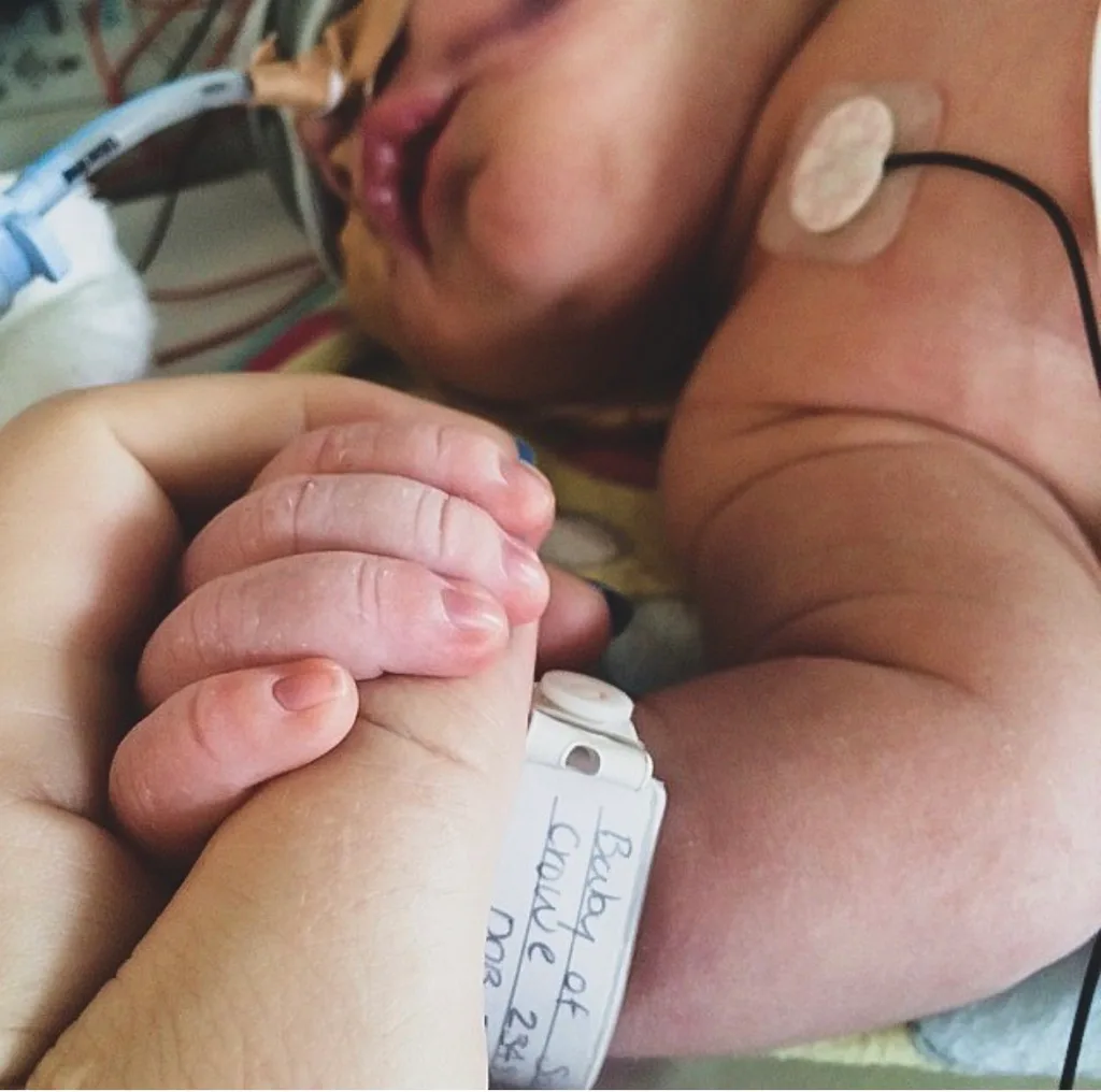 Sally's boy was born not breathing