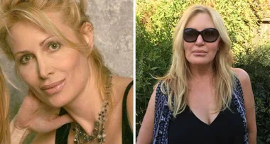 I was blinded by my botched beauty treatment