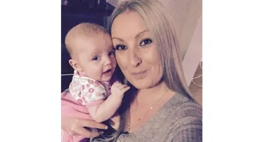 Having a baby made my skin fall off!