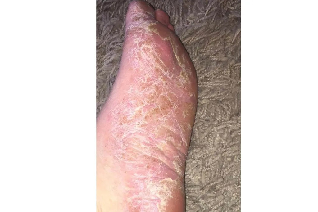 Nicole Preece's foot