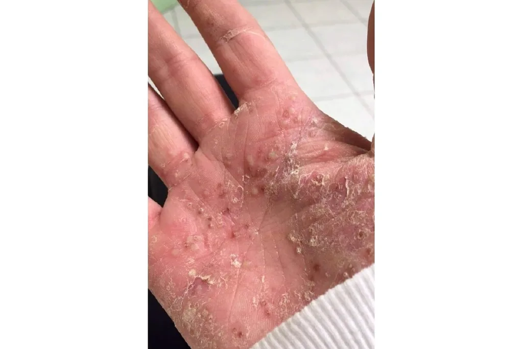 Nicole Preece's hand