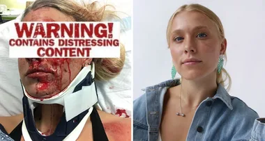 Crushed by my own car – How I survived!