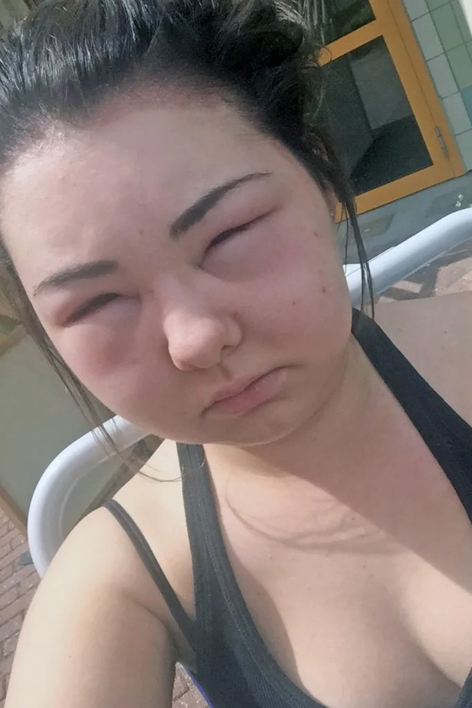 Blinded by my hair dye