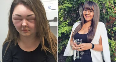 Blinded by my hair dye: ‘I looked like an alien!’