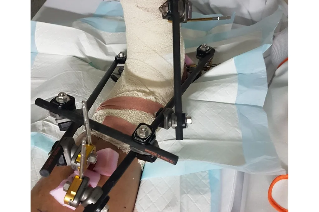 Neil Parker's injured foot
