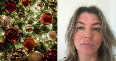 FESTIVE FAIL: ‘I’m allergic to Christmas trees!’