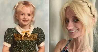 I’m ageing EIGHT TIMES FASTER than normal!