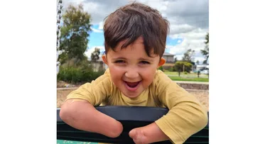 Born with no hands – but nothing will stop my boy