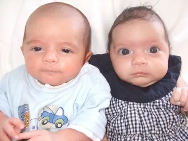 Brave Bella – saved by her twin!