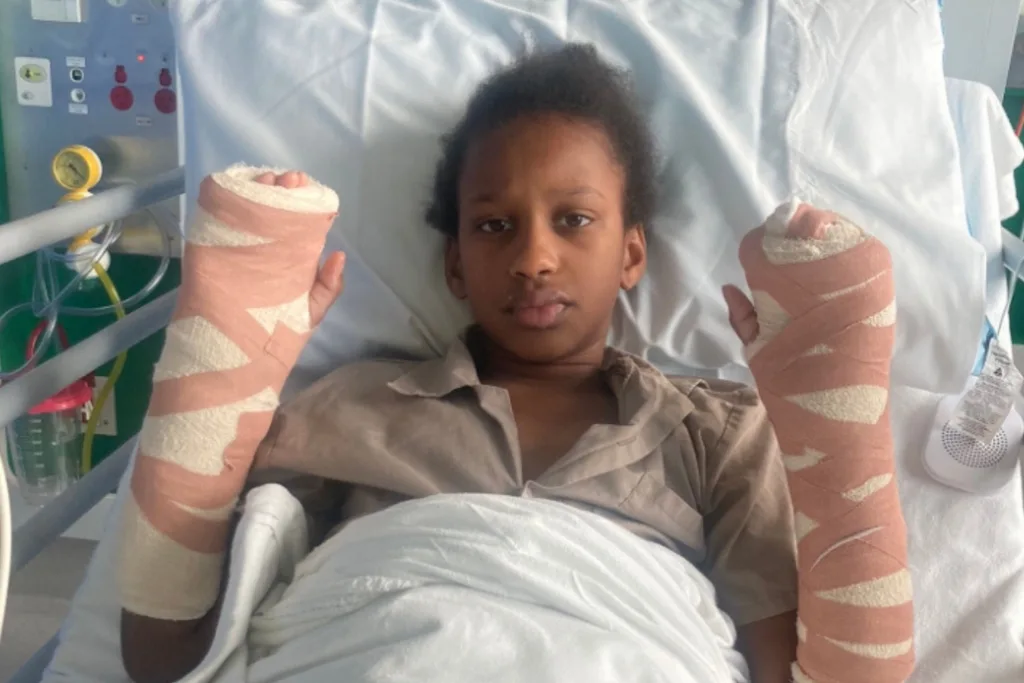 Mandy Sibaly's daughter in hospital being treated for burns