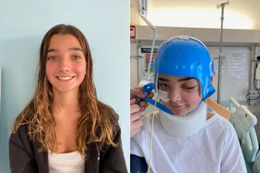 A Propeller Sliced Through My Girl’s Skull