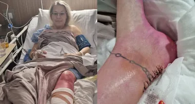 Aussie Mum Speared By A Stingray