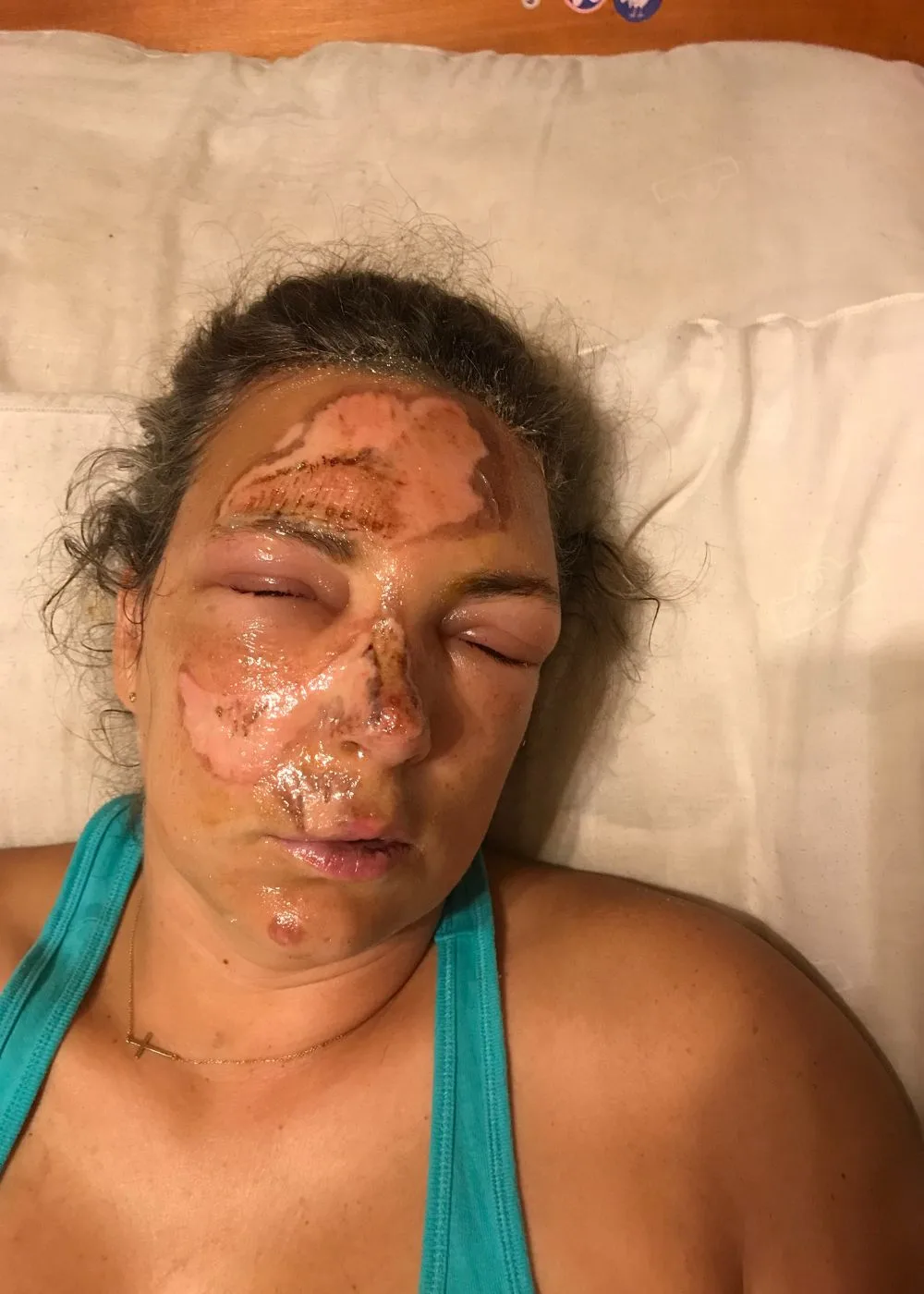 Scrubbing my skin was so painful