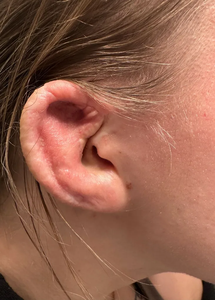 Taylor Duda new ear
