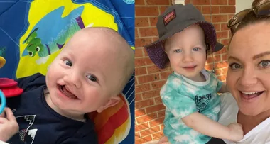 Baby Hunter's journey from cleft lip surgeries to his beautiful smile has been nothing short of miraculous.
