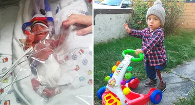 He lost his leg at four days old…