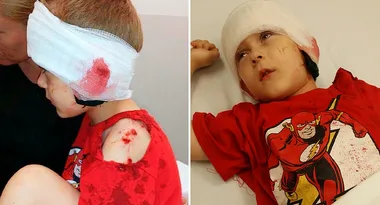Attacked before his birthday party