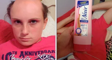 Shocking photo of woman who confused hair-removal cream with shampoo