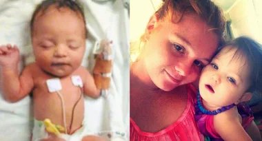 Doctors said it was reflux – it wasn’t