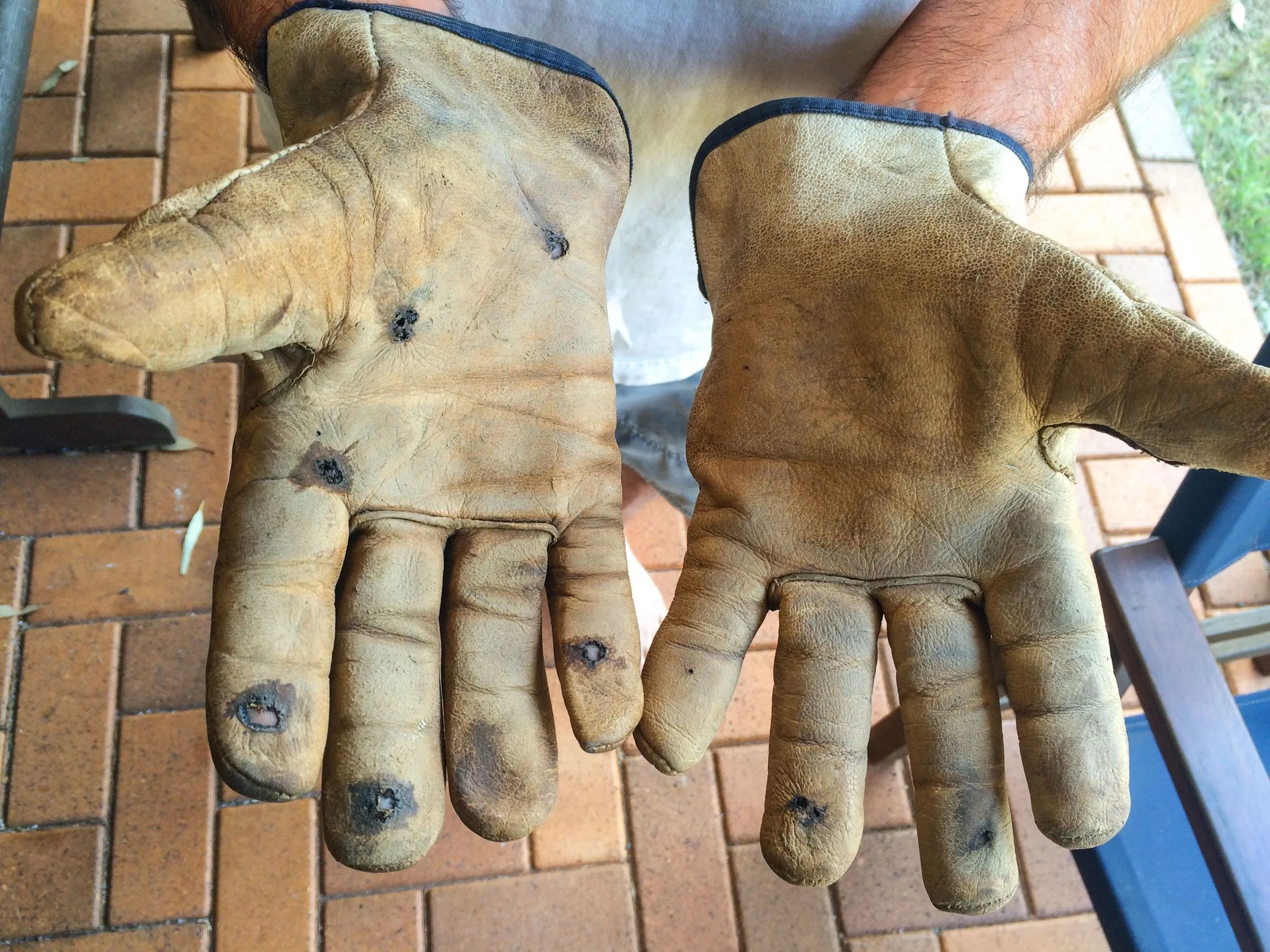 Philip's gloves were badly burned