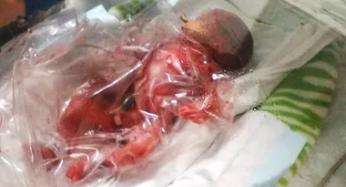 The baby saved by an OVEN bag