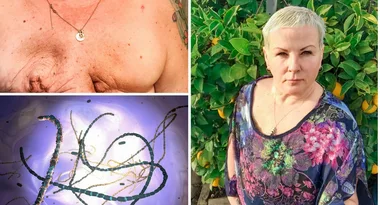 A bug ate my boobs
