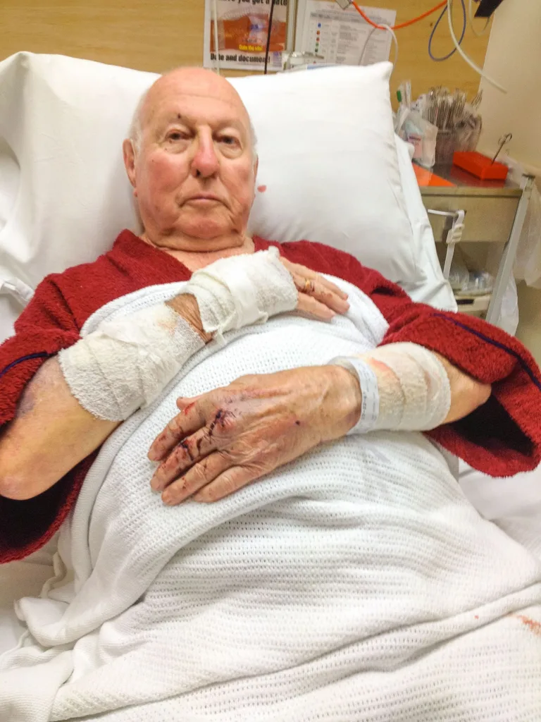 Maurice in hospital following the ordeal