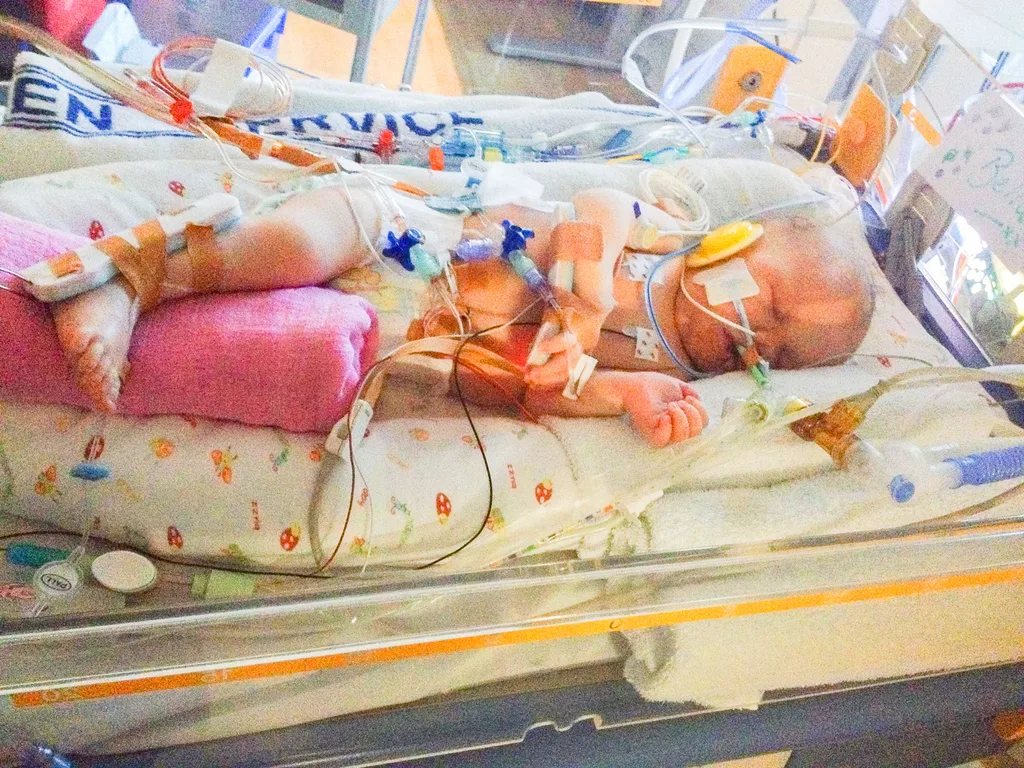 Bella at one day old – after her first surgery
