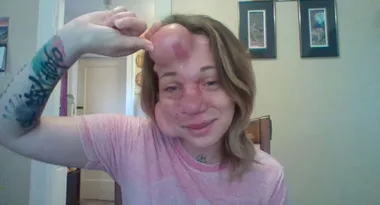 The only way to save this mum was to cut away half her face