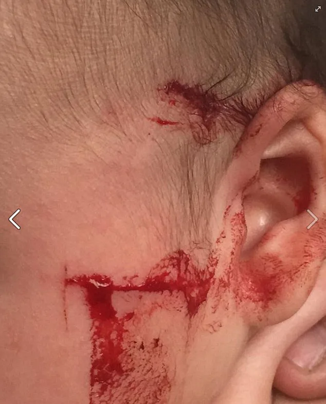 Luckily the cuts were only superficial