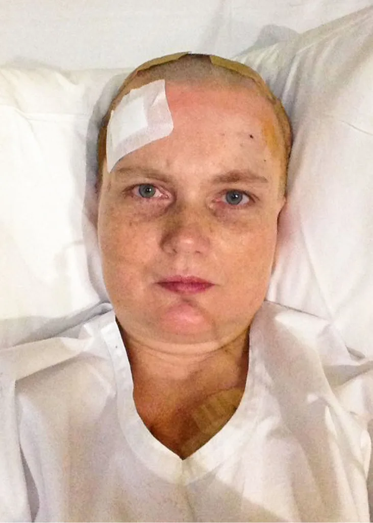 My surgery was a surreal sensation