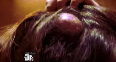 Woman Pops 20-Year-Old Cyst On Live TV