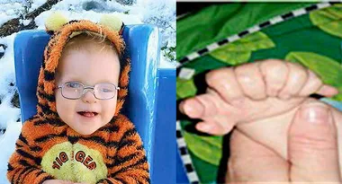 Shocked mum discovers why her little baby had 13 fingers