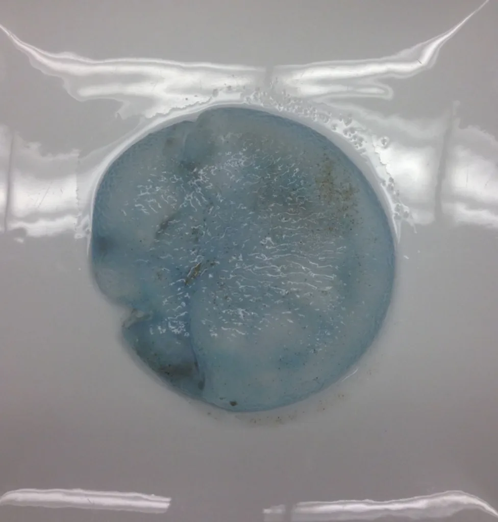 Round, soft object looked like a breast implant