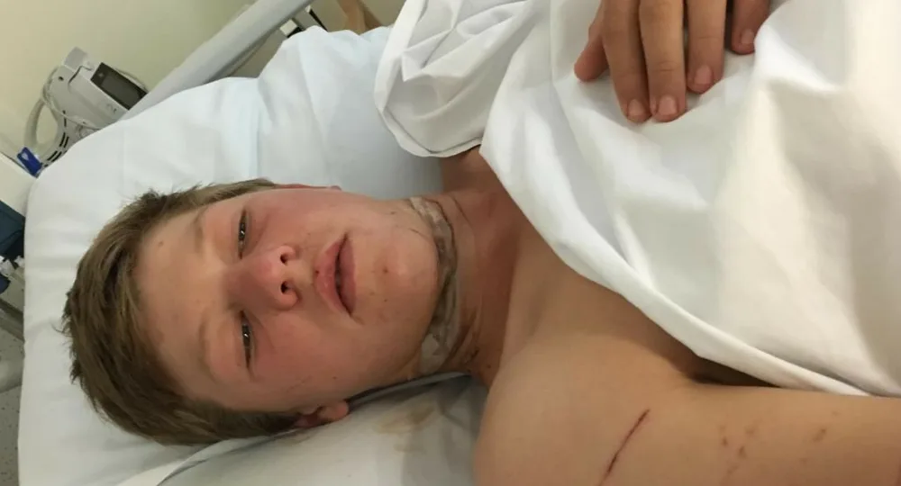Bradley Willoughby after his accident